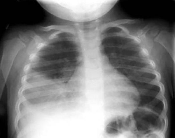 x-ray scan