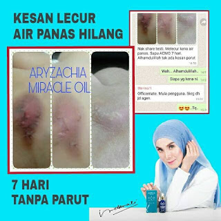 melecur chia oil