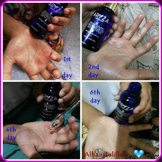 melembapkan kulit minyak chia