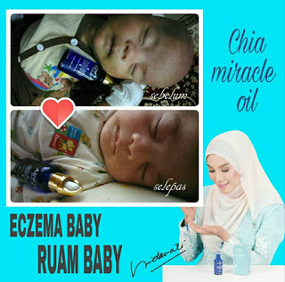 ruam bayi miracle oil