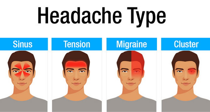  Jenis  jenis Sakit Kepala  dan Rawatan Untuknya ERATUKU